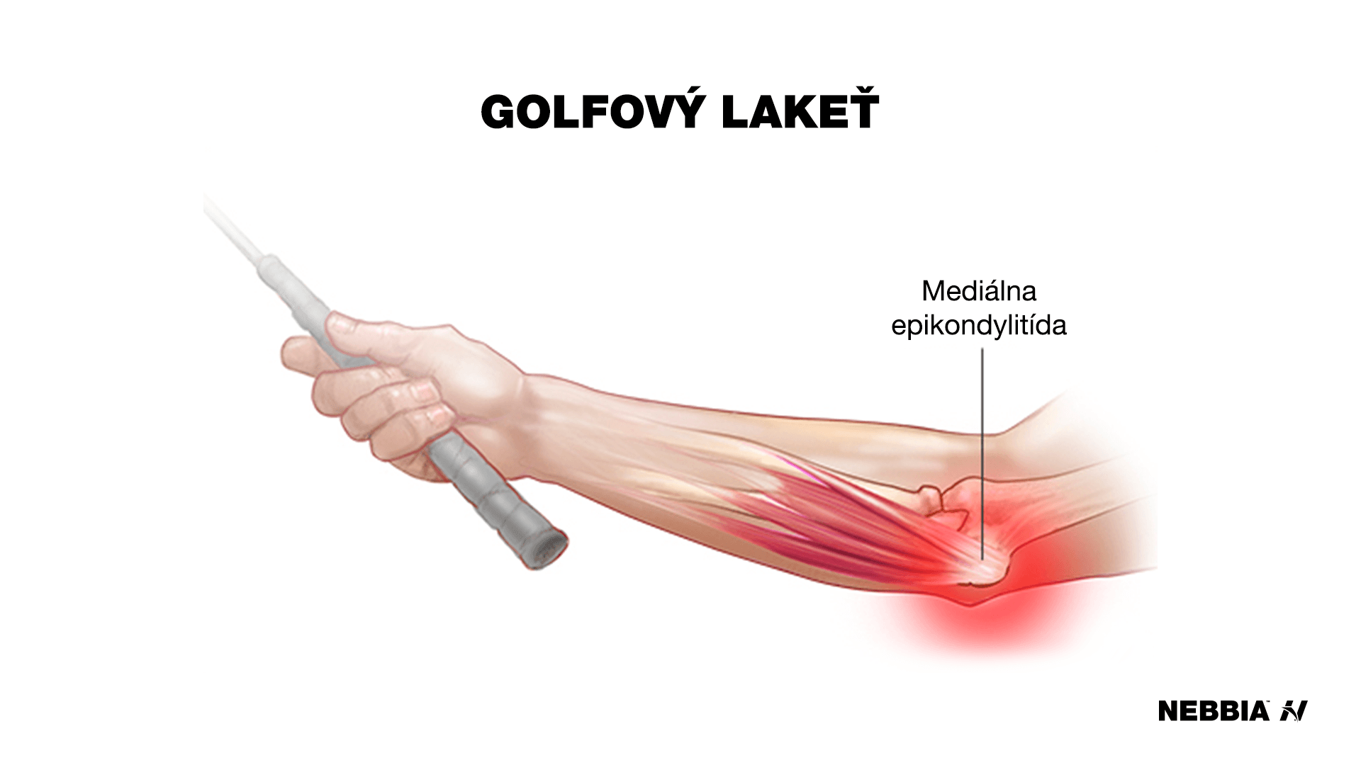 golfový lakeť