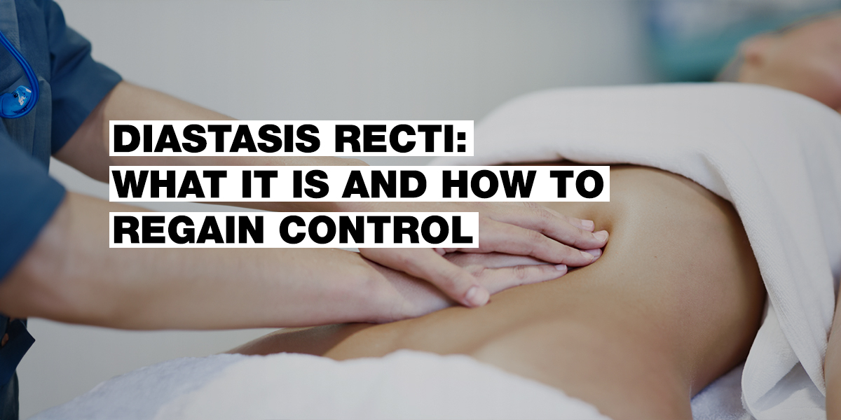 Diastasis: What It Is and How to Manage It | NEBBIA