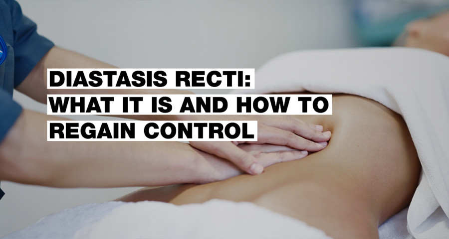 Diastasis: What It Is and How to Manage It